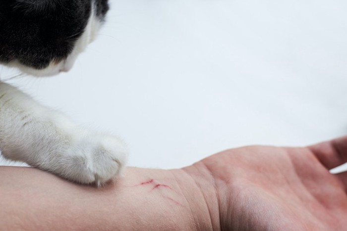 爪を立てる猫と傷ついた人の手
